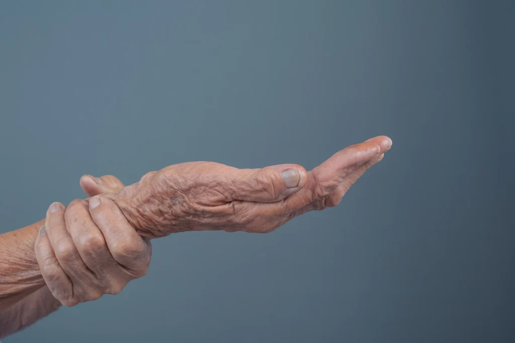 Parkinson cómo frenar el deterioro
